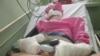 В Афганистане муж отрезал жене нос и губы