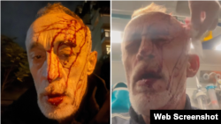 ის კლინიკაში გადაჰყავთ