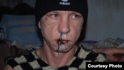 One of the inmates with his mouth sewn up 