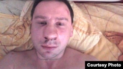 Избитый оппозиционный активист Егор Алексеев