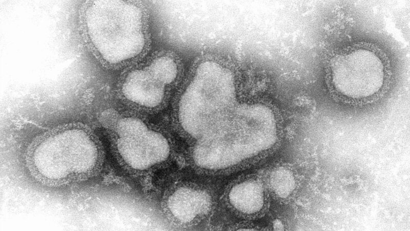 Четиринаесетгодишно девојче почина од грип во Македонија