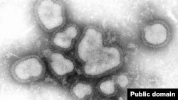 ویروس اچ۱ان۱ زیر میکروسکوپ الکترونی