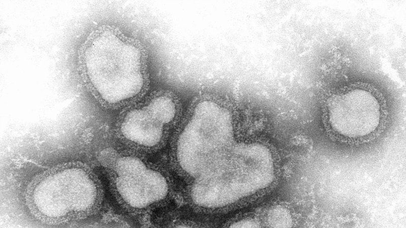 Трет смртен случај од компликации од грип, за 74 отсто зголемен бројот на заболени 