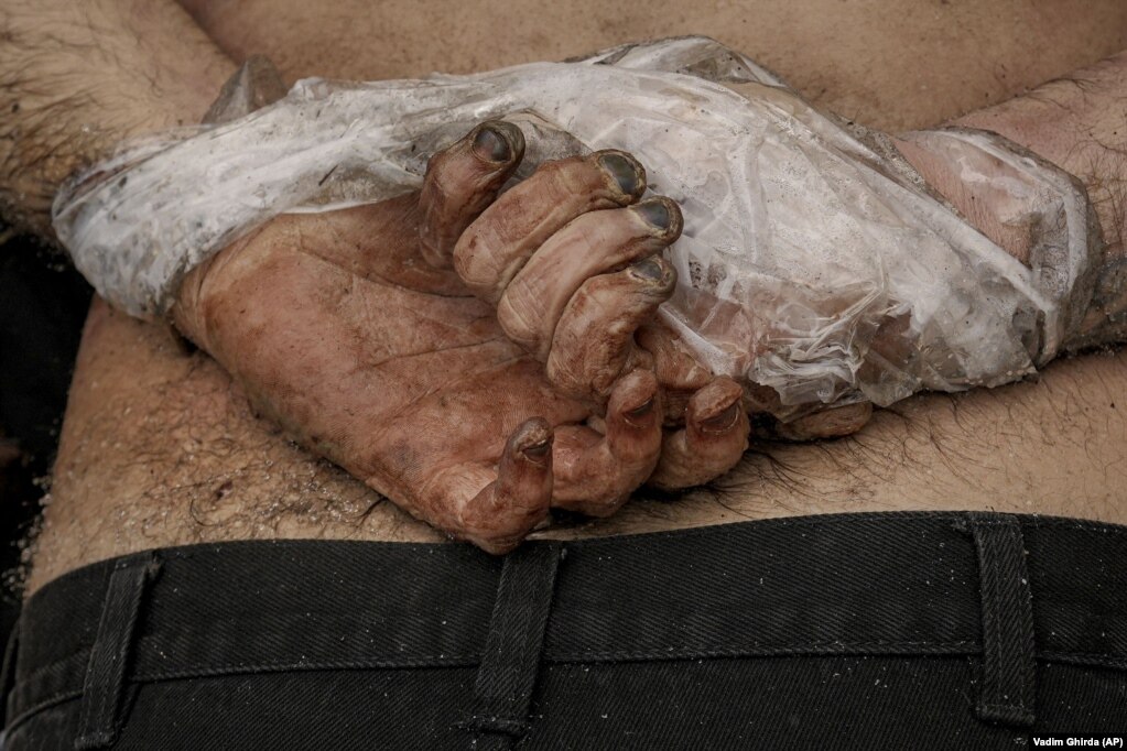 3 aprile 2022, Bucea: il corpo di un uomo, lasciato in strada con le mani legate dietro la schiena.