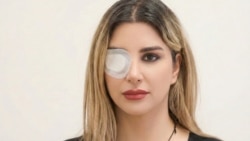 الهه توکلیان: جمهوری اسلامی موفق نشد با نابینا کردن معترضان، مردم را بترساند