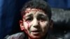 عبدالرحمن: در حملات هوایی روسیه حد اقل ۵۳ ملکی سوری کشته شده‌اند