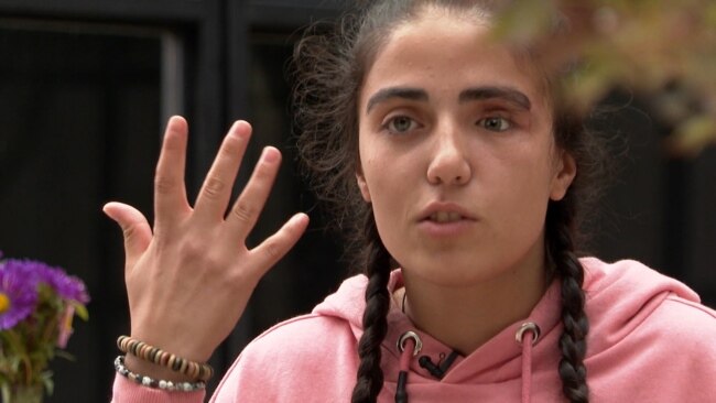 'My Eye Was Gone': Georgian Teen Fights For Justice Months After Protests