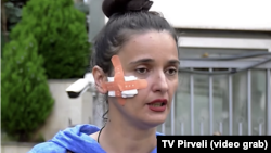 თამაზ ელიზბარაშვილის ადვოკატ ია სარანაშვილის თქმით, მასზე პოლიციელებმა იძალადეს.
