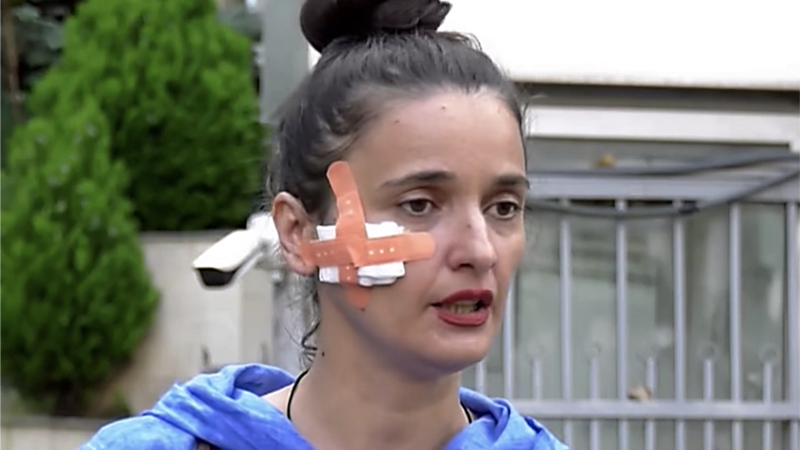 „ერთ ადვოკატზე თავდასხმა ყველა ადვოკატზე თავდასხმაა“ -  ელიზბარაშვილის ადვოკატზე ძალადობის საქმეზე გამოძიება დაიწყო