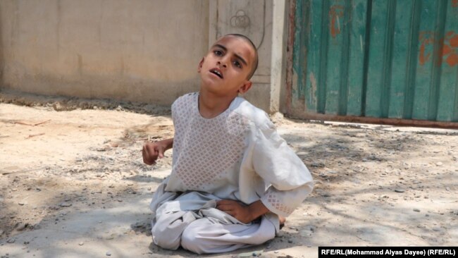 یک طفل مصاب به بیماری فلج