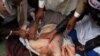 کشتار در صنعا؛ دست‌کم ۳۳ کشته و بیش از ۱۰۰ زخمی در یمن