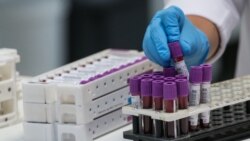 Epidemiologul șef, împotriva testării în masă a populației