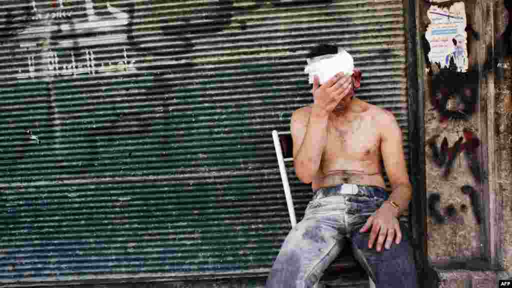 A Syrian man wounded by shelling sits on a chair outside a closed shop in the Al-Muasalat area in Aleppo. (AFP/Achilleas Zavallis)