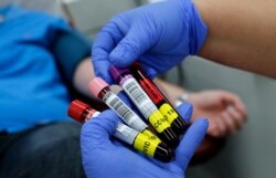 Көрнекі сурет.