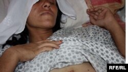 An Afghan woman is treated in a Kabul hospital after being beaten by her husband.