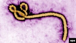 Вирусот ебола.