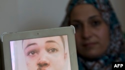مادر نوجوان آمریکایی-فلسطینی، عکسی از او را پس از ضرب و شتم به خبرنگاران نشان می‌دهد