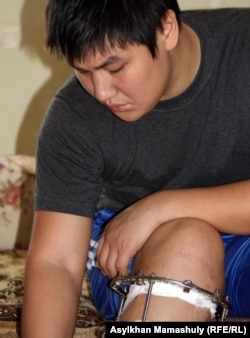 Жанболат с раненой ногой. Жанаозен, 1 мая 2012 года.