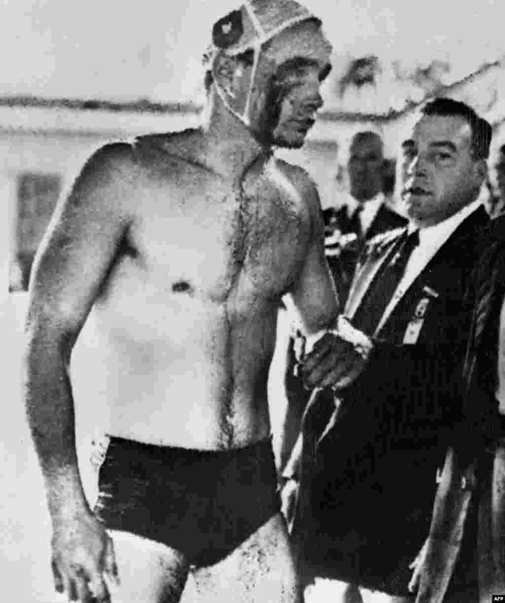 Hungarian water-polo player Ervin Zador after the infamous semifinal against the U.S.S.R. at the Melbourne Olympics in 1956 (just after the Soviet invasion of Hungary). The Hungarians won the bad-tempered match and went on to clinch the gold medal.