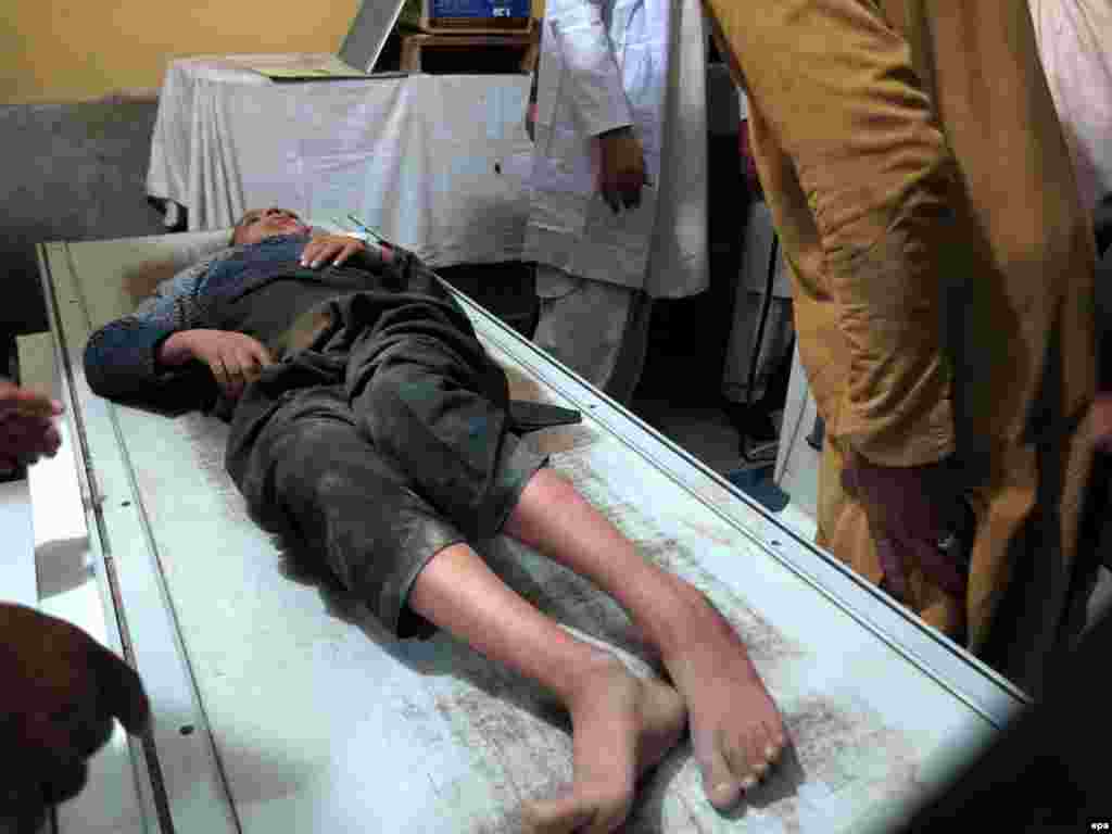 Травмированный мужчина ожидает медицинскую помощь в больнице в Мингаоре, долине Сват, Пакистан.