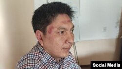 Bolot Temirov had to be treated by paramedics after the attack.