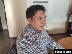 Болот Темиров после нападения.