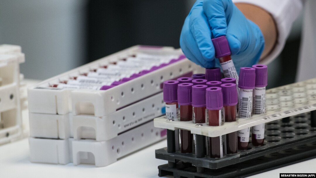 România nu colectează plasma din care se produc imunoglobulinele și atunci nu trimite plasmă la fabricile de medicamente în schimbul medicamentelor. Ca urmare, nu are prioritate la alimentarea cu imunoglobuline. 