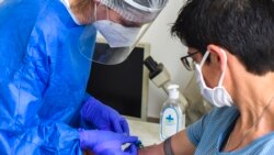 Detalj sa testiranja u bolnici 'Majka Tereza' u Skoplju