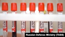 Tubes with the blood of participants in a coronavirus vaccine trial at the Burdenko Main Military Clinical Hospital in Moscow on July 10
