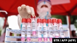 В Крыму продолжают фиксировать рост суточной заболеваемости коронавирусом