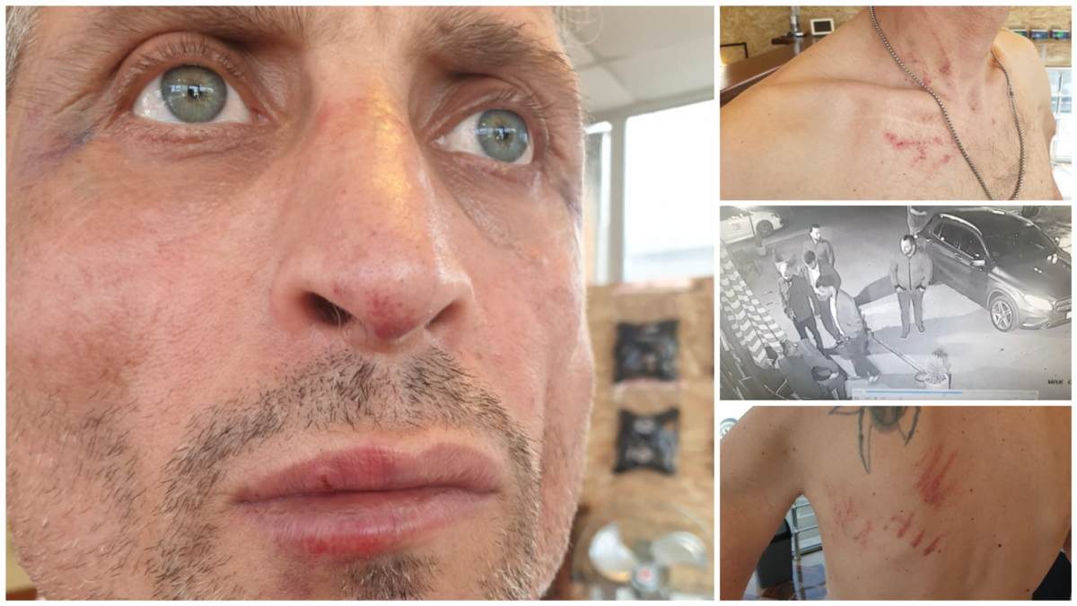 მოქალაქე ამბობს, რომ ფოთის მერის კრიტიკის გამო 5-მა პირმა სცემა