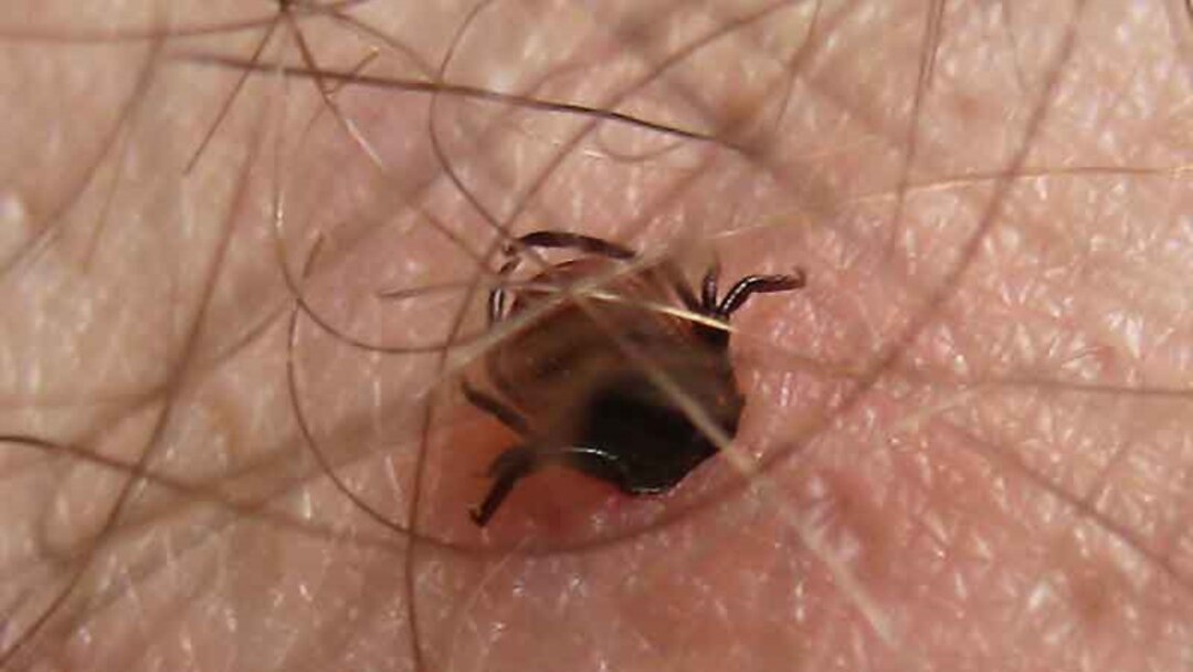 Сексуалды позалар эротикалық қыздар