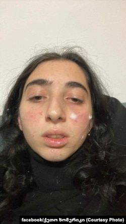 ქეთო ხომერიკი აქციის დაშლის შემდეგ, დეკემბერი, 2024 წელი