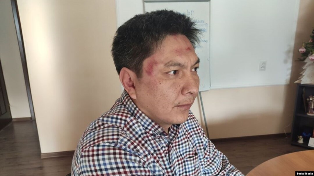 Болот Темиров кол салуудан кийин.