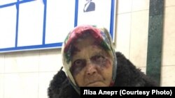 У такім стане Нэлу Чаўтаеву знайшлі валянтэры