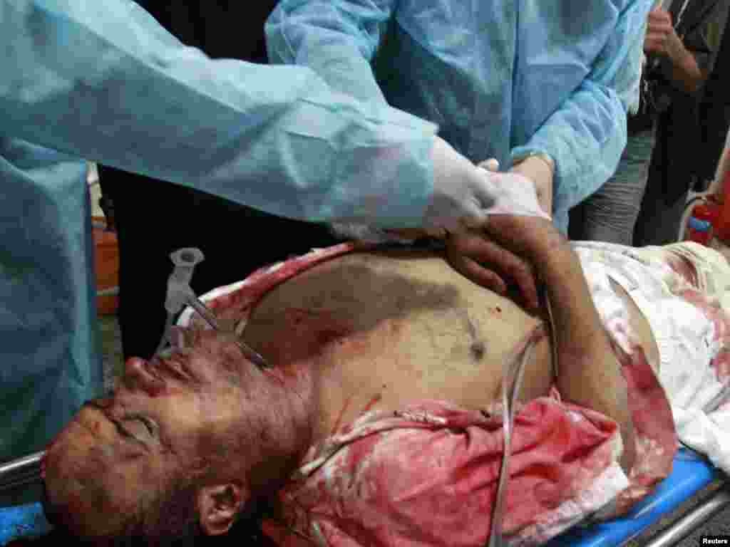 Йемен: Медики перевязывают раны пострадавшему в столкновениях мужчине. г. Сана