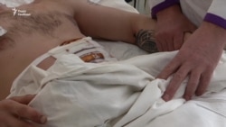 Трьох важко поранених під час обстрілів в Авдіївці доправили до лікарні (відео)