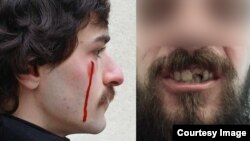 დაშავებული ახალგაზრდები