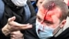 Police Violence A Kick In The Gut To Kremlin Efforts To Tamp Down Protests