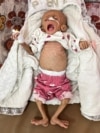 ISRAEL-PALESTINIANS/GAZA-HUNGER-ORGANIZATIONS