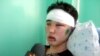 Opposition Journalist Beaten Up In Kazakhstan