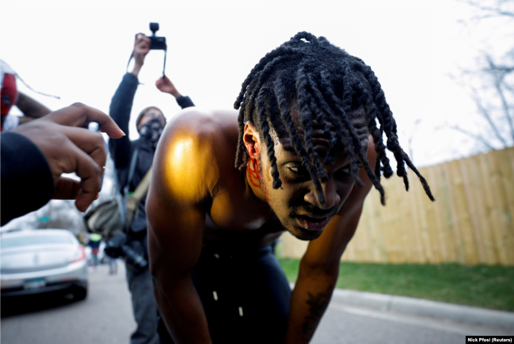 Vigyázat! Felkavaró tartalom! Egy tüntetőt a fején találtak el a rendőrök gumilövedékkel.