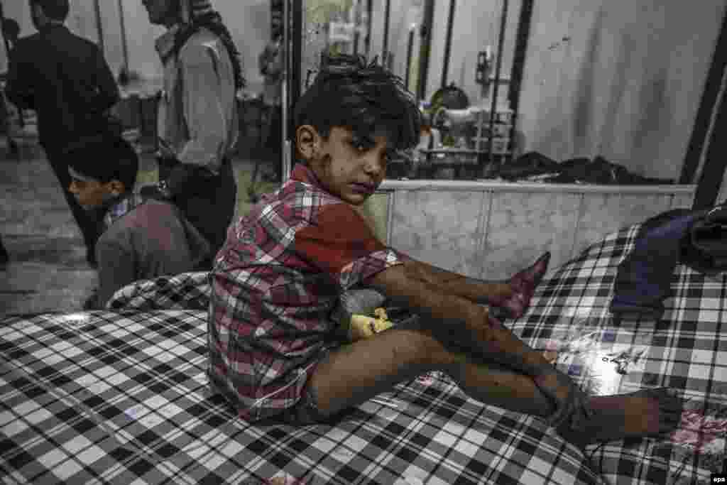 A Syrian boy receives first aid in a field hospital following air strikes by forces loyal to the Syrian government in the rebel-held area of Douma, on the outskirts of the capital, Damascus, on July 10. (epa/Mohammed Badra)