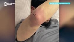 "Это однозначно пытки!" В Кыргызстане возмущены призывом не заступаться за задержанных, которых избивают силовики