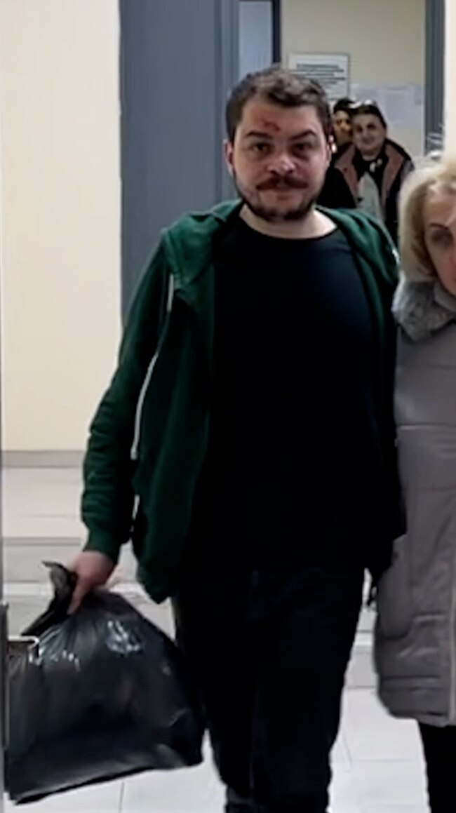 RFE/RL Journalist Released In Georgia Describes Police Beatings