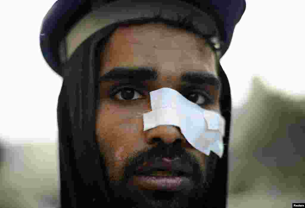 An injured protester takes part in mass demonstrations in Tahrir Square on February 9, 2011.