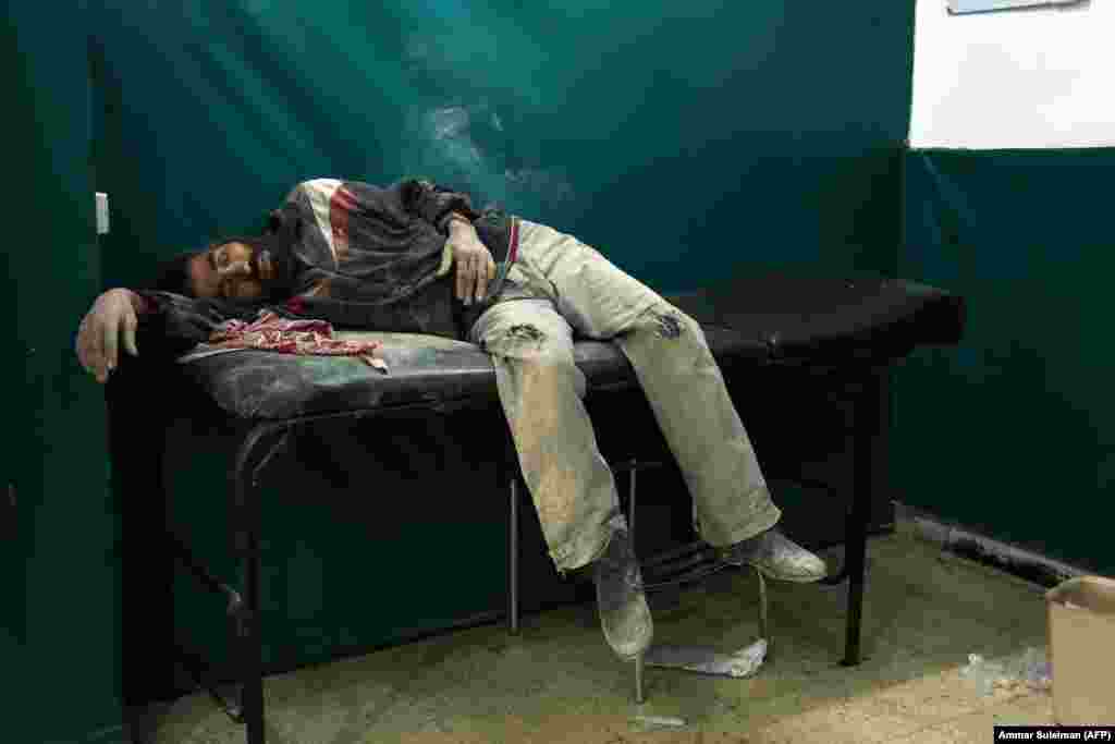 A Syrian man awaits treatment at a makeshift hospital in Zamalka, near Syria's capital, Damascus, following reported shelling. (AFP/Ammar Suleiman)