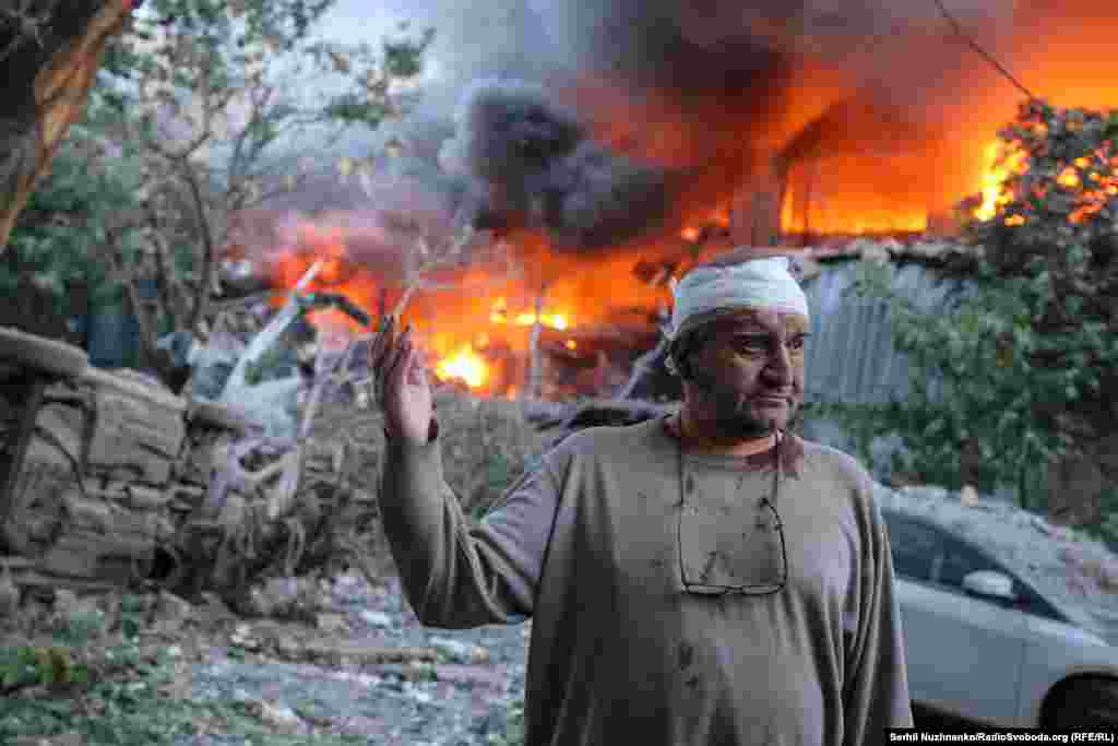 A wounded man reacts at the site of a Russian strike on a suburb of Kyiv.According to Ukraine's State Emergency Service, 13 people were killed in cities throughout Ukraine and over 100 were injured as a result of a Russian missile and drone attack in the early hours of June 2.