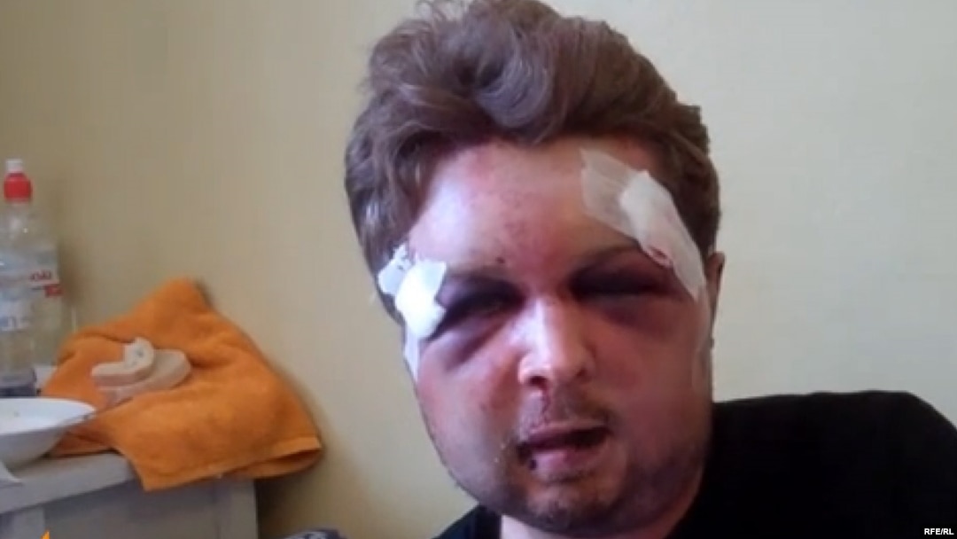 Viktor Svyatskiy was brutally beaten late on July 24, leaving him with a broken jaw and missing teeth.