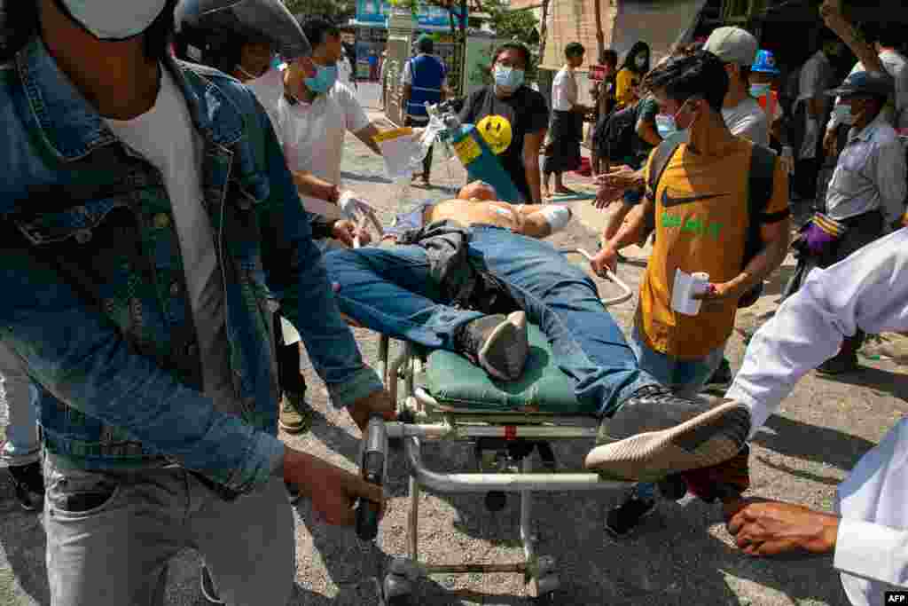 Протестувальник, поранений з вогнепальної зброї, доставлений в тимчасовий медичний центр в Мандалаї, 28 лютого 2021 року